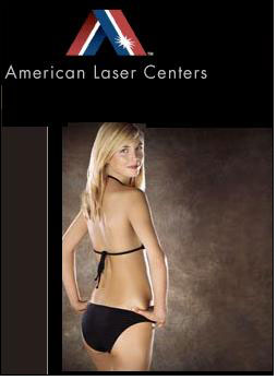 American Laser Centers
